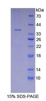 Mouse LDHA / LDH1 Protein (Recombinant His)