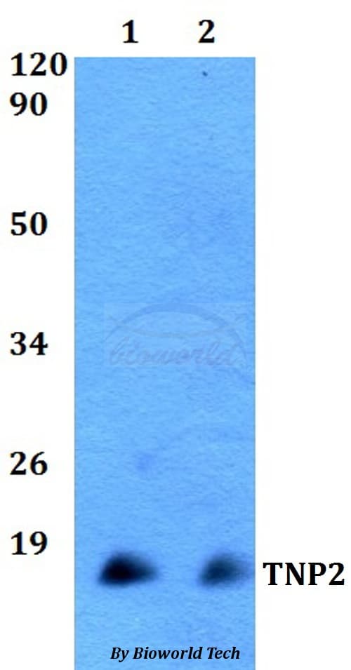 TP-2 / TNP2 Antibody