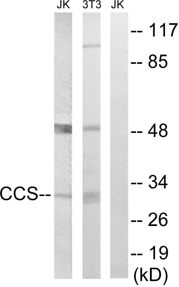 CCS Antibody