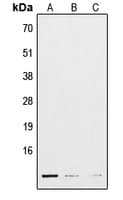 Polyclonal Rabbit anti-Human C11 / POLR3K Antibody (Internal, WB)