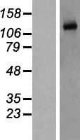 Human NOS3 / eNOS Protein (Over-Expression Lysate Myc-DDK (Flag))