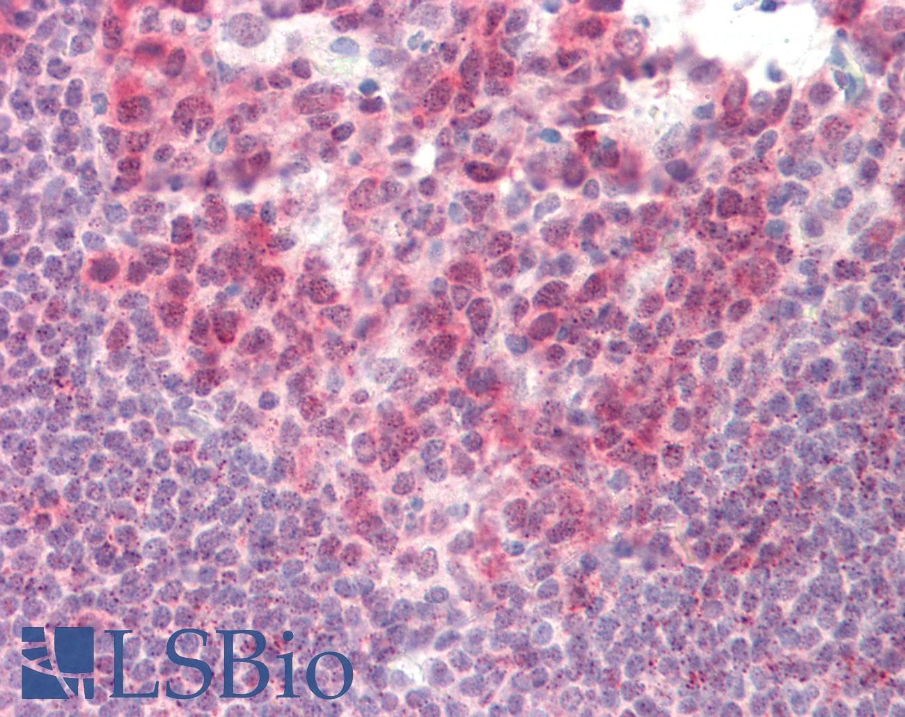 IHC-plus™ Monoclonal Mouse anti-Human MCL1 / MCL 1 Antibody (clone 2E11, IHC, IF, WB)