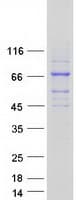 Human ACS5 / ACSL5 Protein (Recombinant Myc-DDK (Flag))