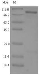 Human SIRT1 / Sirtuin 1 Protein (Recombinant 6His, N-terminus)