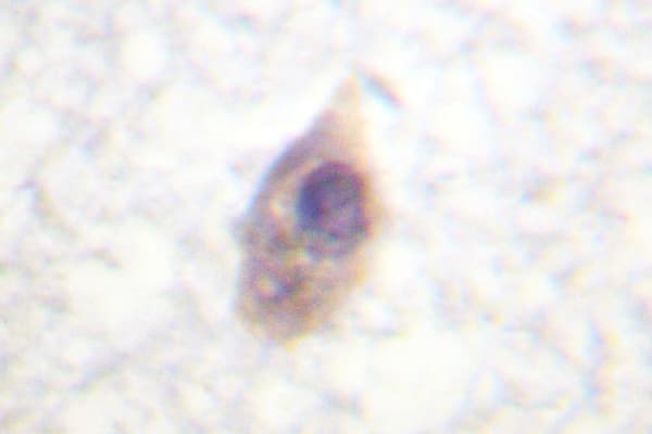 CDC25B Antibody (Lys349)
