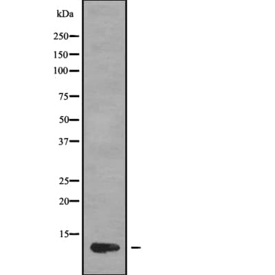 Polyclonal Rabbit anti-Human I-309 / CCL1 Antibody (IHC, WB)