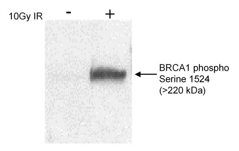BRCA1 Antibody (phospho-Ser1524)
