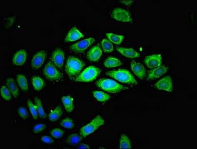 Polyclonal Rabbit anti-Human TESPA1 / KIAA0748 Antibody