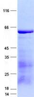 Human WNT11 Protein (Recombinant GST, N-terminus + His, C-terminus)