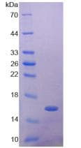Mouse GLP1R / GLP-1 Receptor Protein (Recombinant 6His, N-terminus)