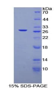 Rat ARA55 / HIC-5 Protein (Recombinant His-T7)