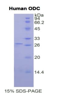 Human ODC1 / Ornithine Decarboxylase Protein (Recombinant His)