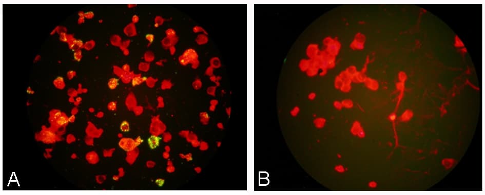 HMPV / Metapneumovirus Antibody (clone HMPV123)