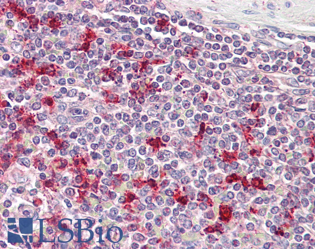 IHC-plus™ PTMA / Prothymosin Alpha Antibody (aa89-101)