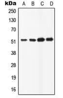 Polyclonal Rabbit anti-Human ATP6AP1 Antibody (C-Terminus, WB)