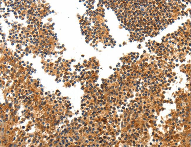 Polyclonal Rabbit anti-Human TERT / Telomerase Antibody (IHC)