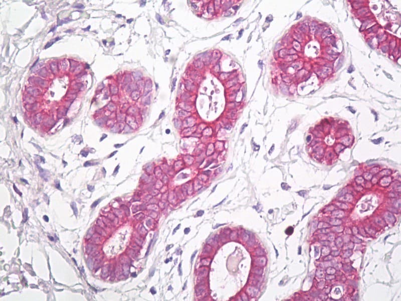 IHC-plus™ EDNRA / Endothelin A Receptor Antibody (aa378-427)