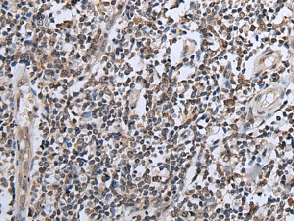 Polyclonal Rabbit anti-Human CXCL6 Antibody (IHC)