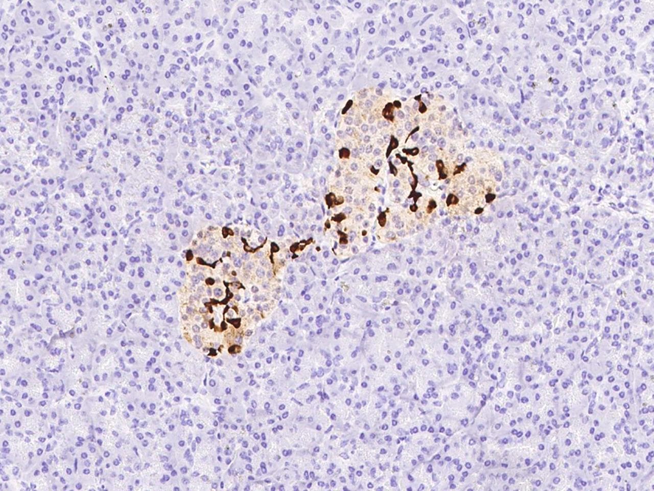 SST / Somatostatin Antibody (Preservative Free)