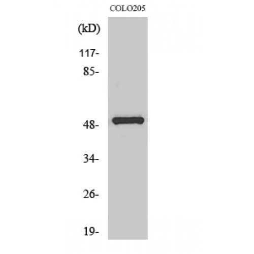 PPP4R1L Antibody (160-240 aa, Internal)