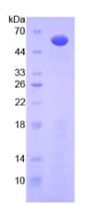 Mouse IL10RA Protein (Recombinant His-GST)