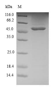 Human S100A12 Protein (Recombinant GST, N-terminus)