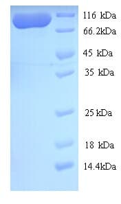 Aquifex aeolicus MutS Protein (Recombinant 6His, N-terminus)