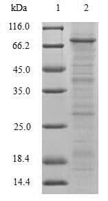 Human TRIM5 Protein (Recombinant 6His-B2M, N-terminus)