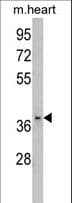 Polyclonal Rabbit anti-Human FBP2 Antibody (aa250-281, WB)