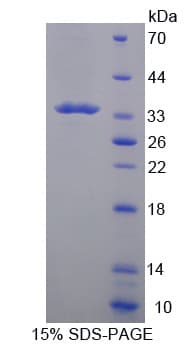 Tpsb2 / Tryptase Beta 2 (Mouse Protein (Recombinant His-T7)