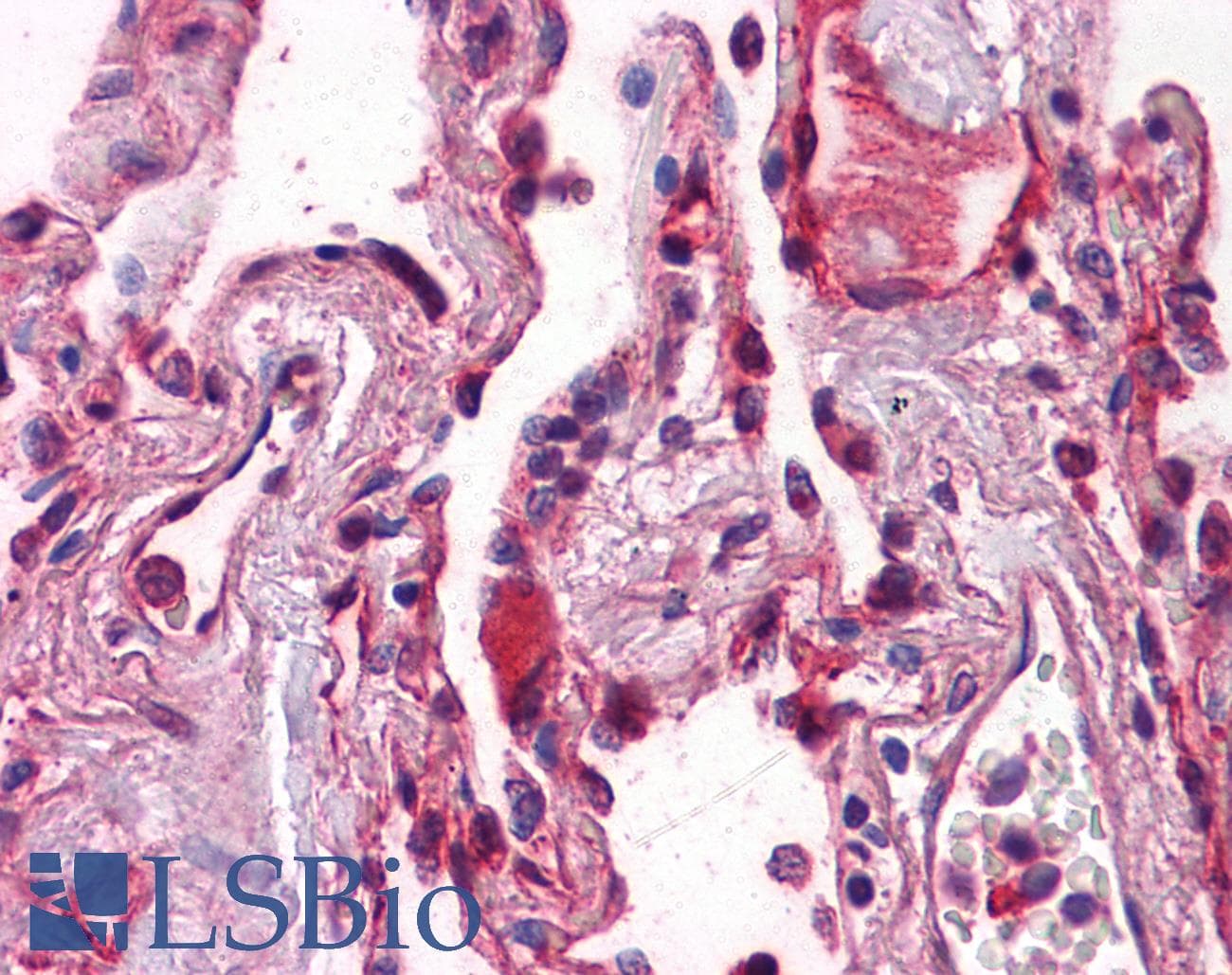 IHC-plus™ CDH1 / E Cadherin Antibody (clone 3F4)