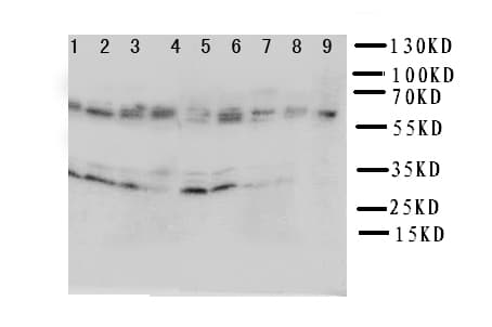 Polyclonal Rabbit anti-Human IL5RA / CD125 Antibody (aa53-68, WB)