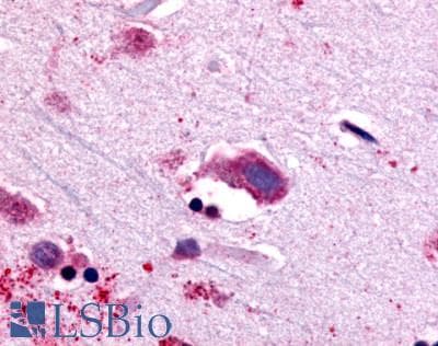 IHC-plus™ NTSR1 / NTR Antibody (C-Terminus)