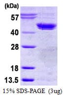 Human CSNK2A1 Protein (Recombinant His)