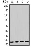 AK4 / Adenylate Kinase 4 Antibody