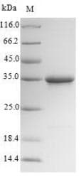 Mouse TMEM27 / Collectrin Protein (Recombinant 10His-SUMO, N-terminus + Myc, C-terminus)