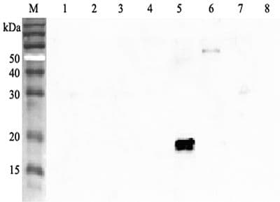 ANGPTL4 Antibody (aa79-101)