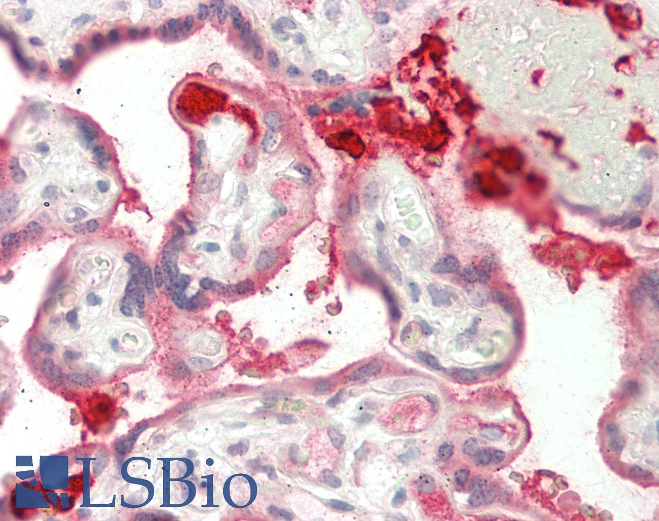 IHC-plus™ Polyclonal Rabbit anti-Human PECAM-1 / CD31 Antibody (aa231-280, IHC, WB)