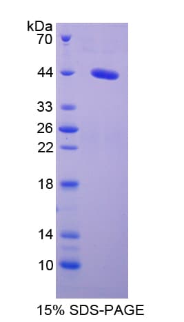Mouse SAA1 / SAA / Serum Amyloid A Protein (Recombinant His-GST)
