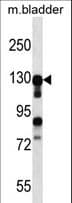 MKL2 Antibody (aa72-101)