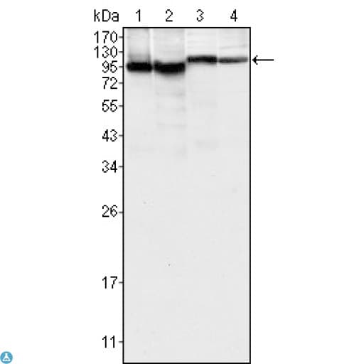 BTK Antibody