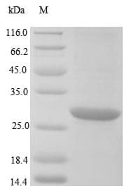 Klebsiella pneumoniae blaNDM-1 Protein (Recombinant 6His, N-terminus)