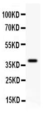 Polyclonal Rabbit anti-Human FHIT Antibody (aa1-147, IHC, WB)