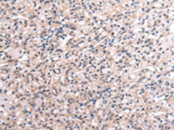 RNF115 / BCA2 Antibody
