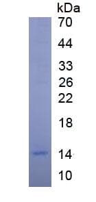 Human IGF1 Protein (Recombinant 6His, N-terminus)