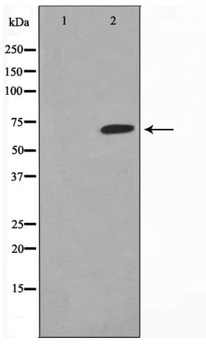 Polyclonal Rabbit anti-Human F2 / Prothrombin / Thrombin Antibody (IHC, IF, WB)