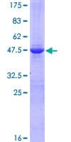 Human HSPB8 / H11 / HSP22 Protein (Recombinant GST)