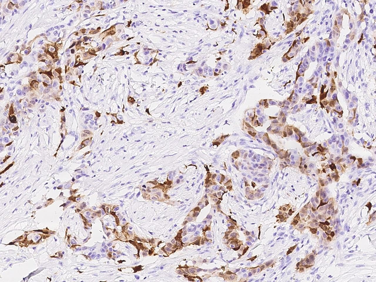S100A8 / MRP8 Antibody (clone 03, Preservative Free)