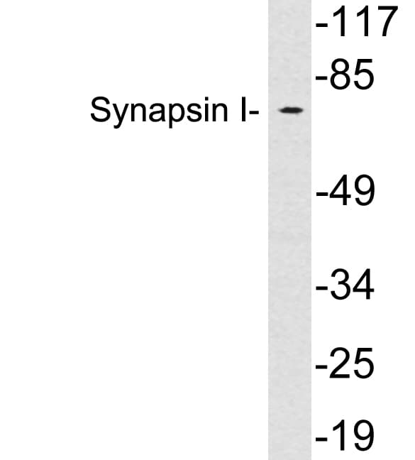 Polyclonal Rabbit anti-Human SYN1 / Synapsin 1 Antibody (aa504-553, WB)
