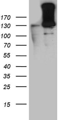 HIF1A / HIF1 Alpha Antibody (aa531-826, clone OTI2D5)